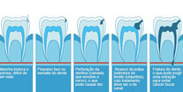 Preveno Dentria