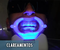 Clareamentos